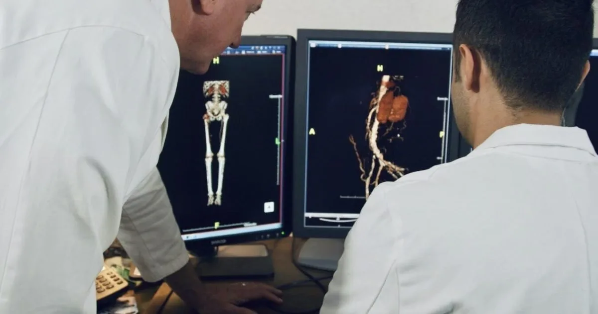 Uterine Fibroid Embolization