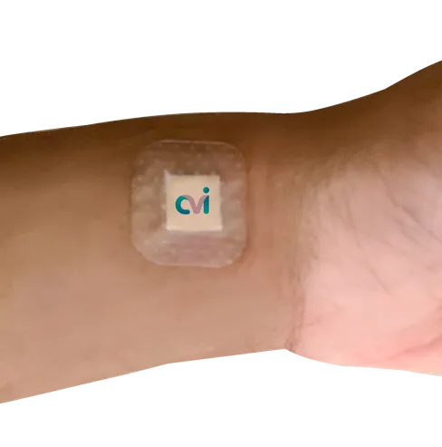 Uterine Artery Embolization - 1